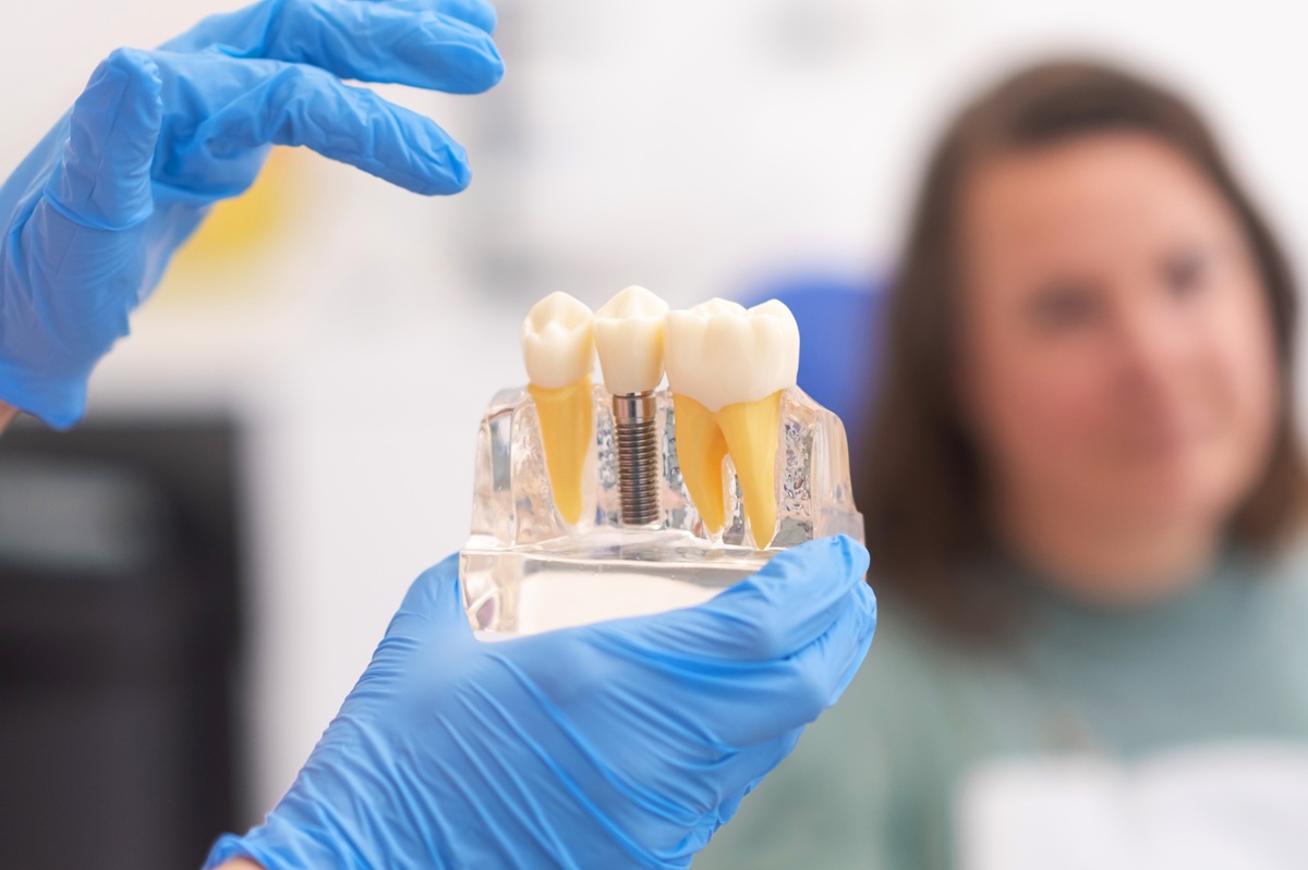 dentist explaining risks of delaying implant